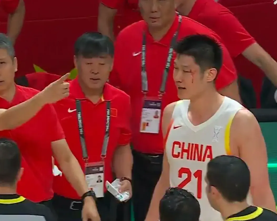 眼瞎, 细节, alt 眼瞎, 细节, alt